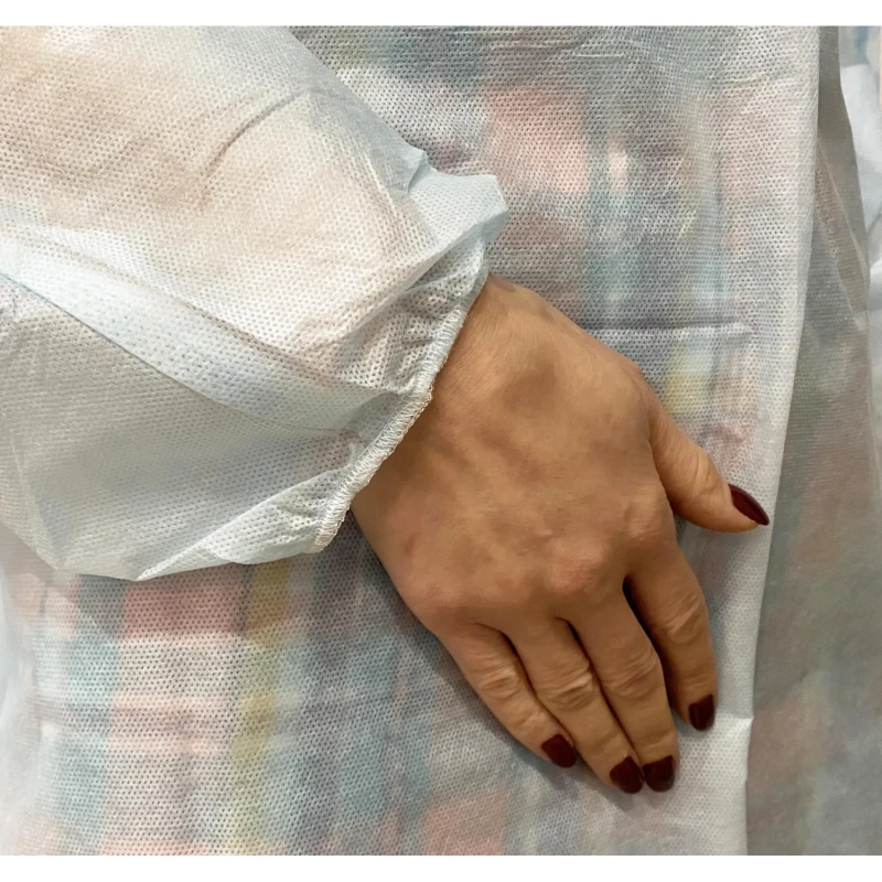 Халат хирург. стер, рук.рез, дл.140 см, р.54-56, пл.25, смс, 1шт