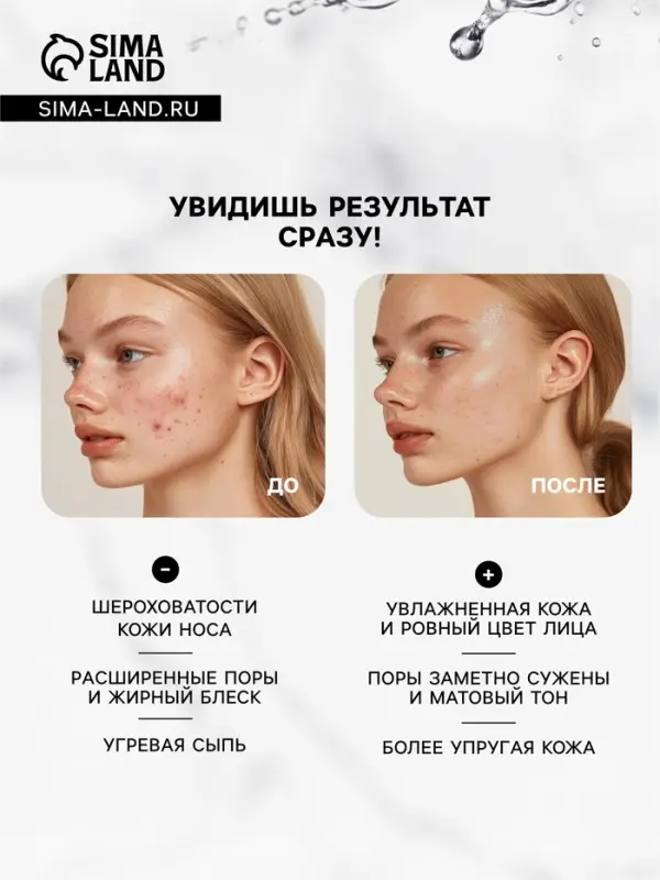 Маска грязевая с прополисом от прыщей и угревой сыпи &laquo;Лицо без проблем&raquo;, 10&times;15 мл