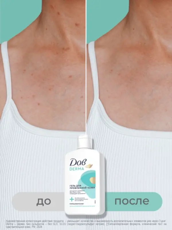 Гель для душа и умывания "Дав" для проблемной кожи, 280 мл