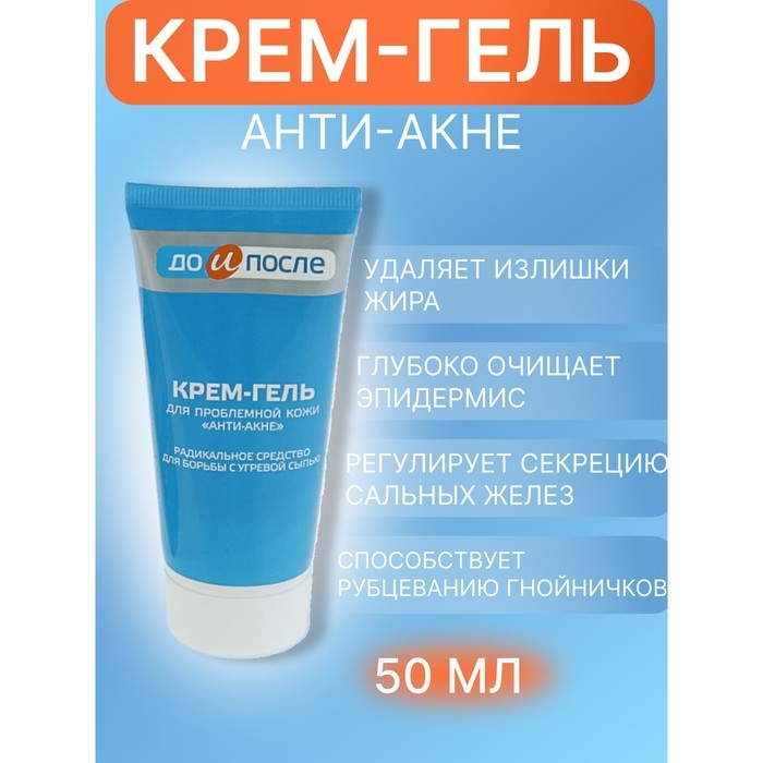 Крем-гель  Крем-гель "До и После" Анти-Акне  для проблемной кожи, 50 мл