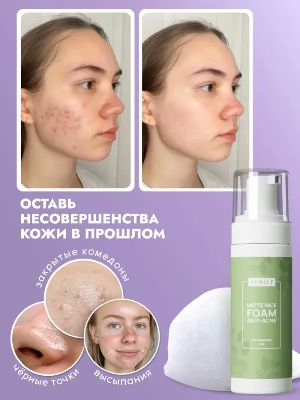 Пенка для умывания матирующая SEMILY против акне, 150 мл