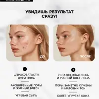 Патчи от прыщей и воспалений на лице, набор 24 шт.