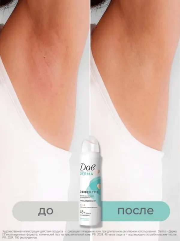 Дезодорант женский гипоаллергенный Дезодорант женский гипоаллергенный "Дав" против сильного пота, 150 мл