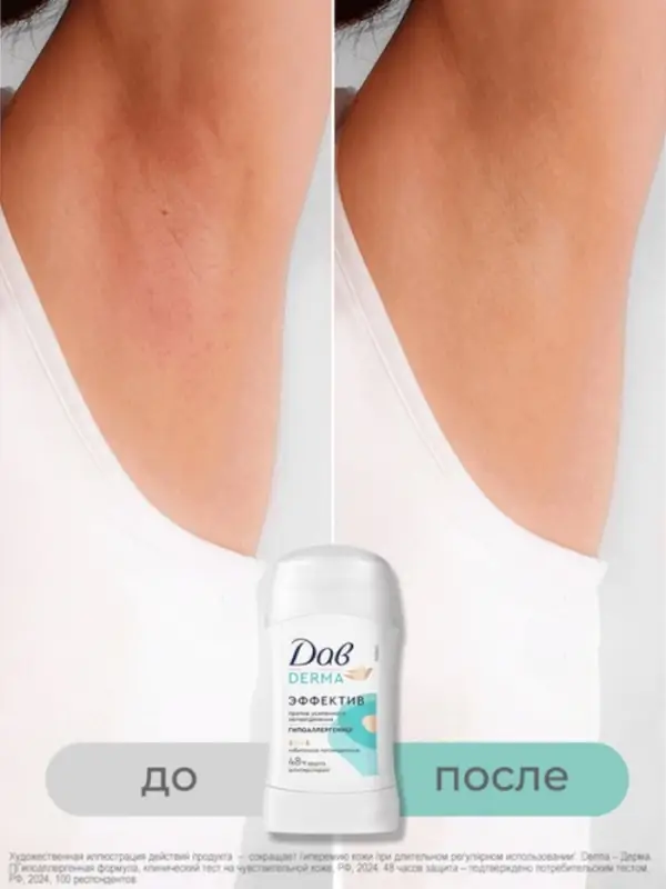 Дезодорант женский гипоаллергенный  Дезодорант женский гипоаллергенный "Дав" против сильного пота, 40 мл