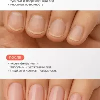 Лак-уход лечебная серия JEANMISHEL 8 в 1 мультикомплекс, 6 мл