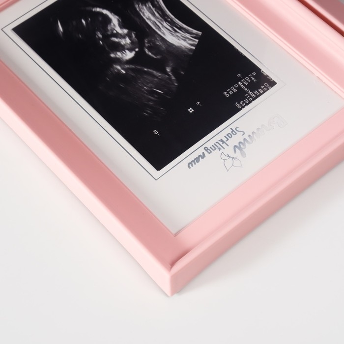 Фоторамка пластик 8х12 см "Наш малыш" розовая с рамкой для УЗИ 2х36,5х22,7 см