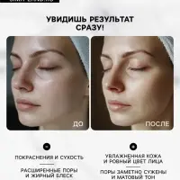 Тканевая маска для детоксикации кожи лица Consly &laquo;После читмила&raquo;, 23 мл