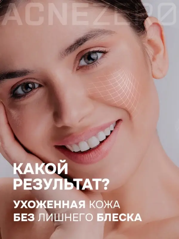 Крем дневной матирующий &laquo;Акнестоп&raquo; для проблемной кожи лица, 30 мл