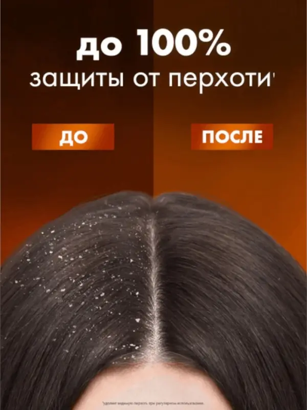 Шампунь для волос против перхоти "Клиар" защита от выпадения волос, 1000 мл