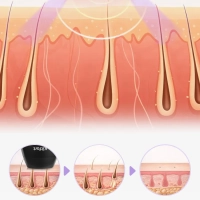 Фотоэпилятор КТ-3129 - 36 Вт