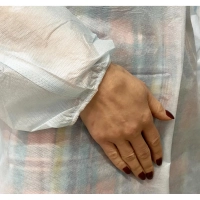 Халат хирург. стер, рук.рез, дл.140 см, р.54-56, пл.25, смс, 1шт