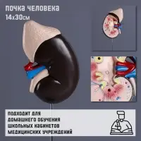 Анатомическая модель &laquo;Макет почки человека&raquo;, 14&times;30 см