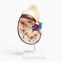 Анатомическая модель &laquo;Макет почки человека&raquo;, 14&times;30 см