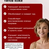 Натуральная мазь от Псориаза, &laquo;Святая рука&raquo;, 100 мл