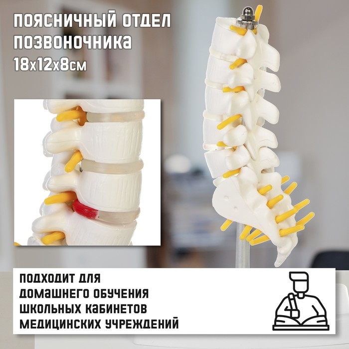 Макет  Макет "Поясничный отдел позвоночника" 18*12*8см