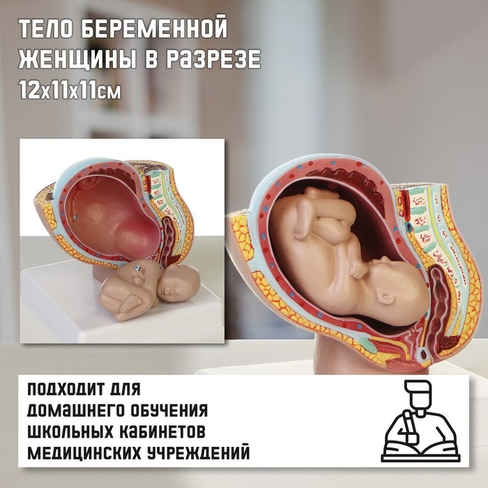 Макет  Макет "Тело беременной женщины в разрезе" 12*11*11см