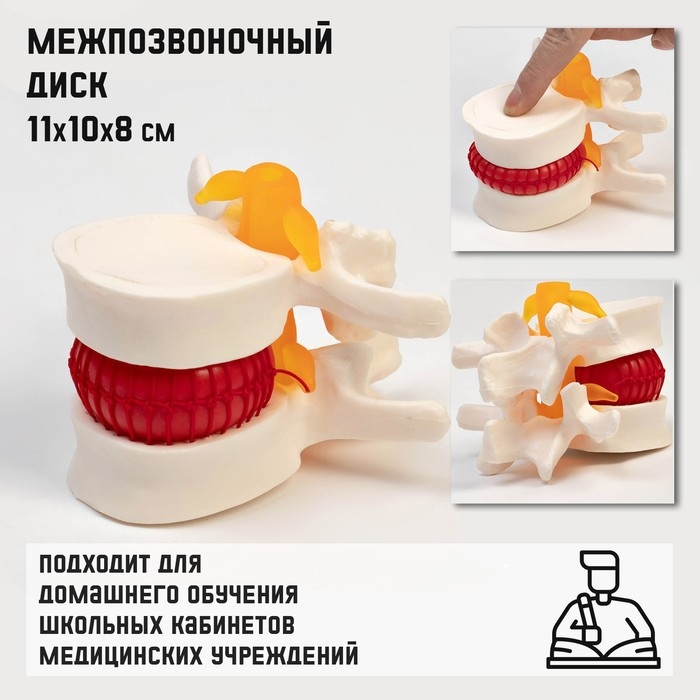 Макет  Макет "Межпозвонковый диск" 11*10*8см