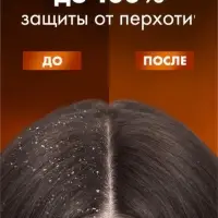 Шампунь для волос против перхоти "Клиар" защита от выпадения волос, 1000 мл Шампунь для волос против перхоти "Клиар" защита от выпадения волос, 1000 мл