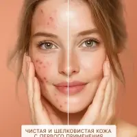Гель для умывания SENDO от акне anti-acne cleansing gel, 200 мл