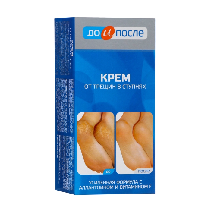 Крем для ног  Крем для ног "До и После" от трещин в ступнях, 150 мл