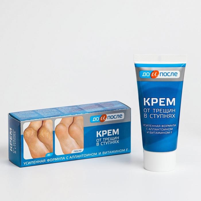 Крем для ног от трещин в ступнях,  Крем для ног от трещин в ступнях, "До и После", 50 мл