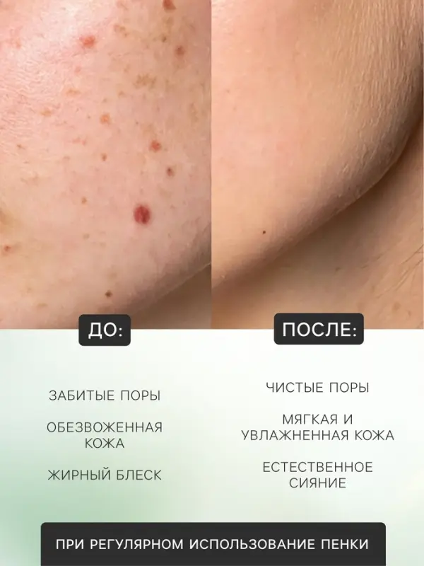 Пенка для умывания, алое вера, 120 мл