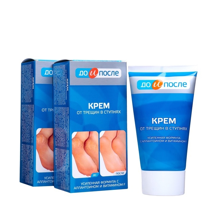 Крем для ног  Крем для ног "До и После" от трещин в ступнях, 2 шт по 150 мл