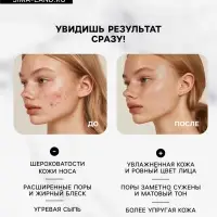 Маска для лица пузырьковая Floresan с черным углем, 15 мл