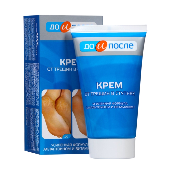 Крем для ног  Крем для ног "До и После" от трещин в ступнях, 150 мл