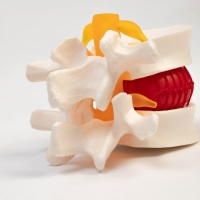 Макет "Межпозвонковый диск" 11*10*8см