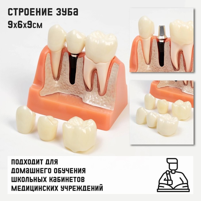 Макет  Макет "Строение зуба" 9*6*9см