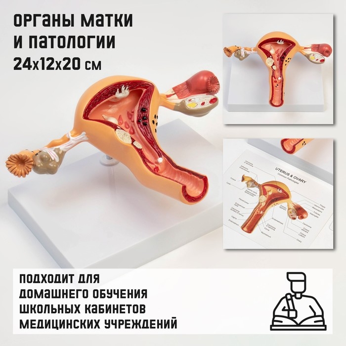 Макет  Макет "Органы матки, патологии" 24*12*20см