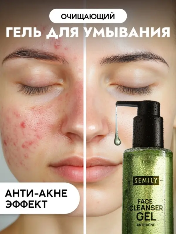 Гель для умывания очищающий SEMILY против акне, 200 мл