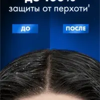 Шампунь-бальзам мужской против перхоти "Клиар" активспорт, 1000 мл