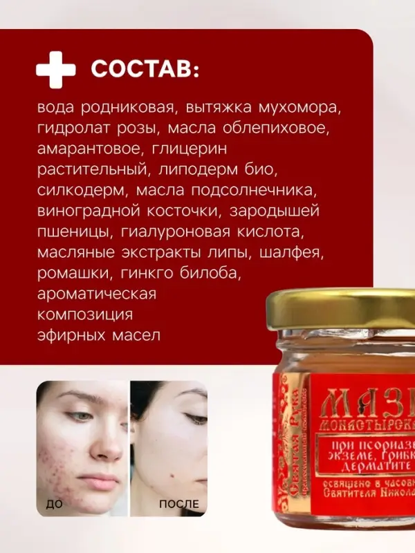 Мазь при псориазе, экземе, грибке, дерматите &laquo;Святая Рука&raquo;, 30 мл